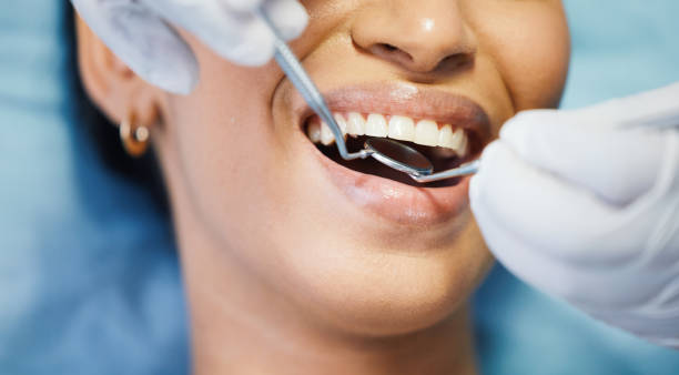 Best Cracked Tooth Emergency Dentist  in Bolivar, OH